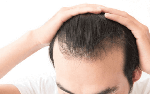 Cách khắc phục gãy rụng tóc vào mùa thu